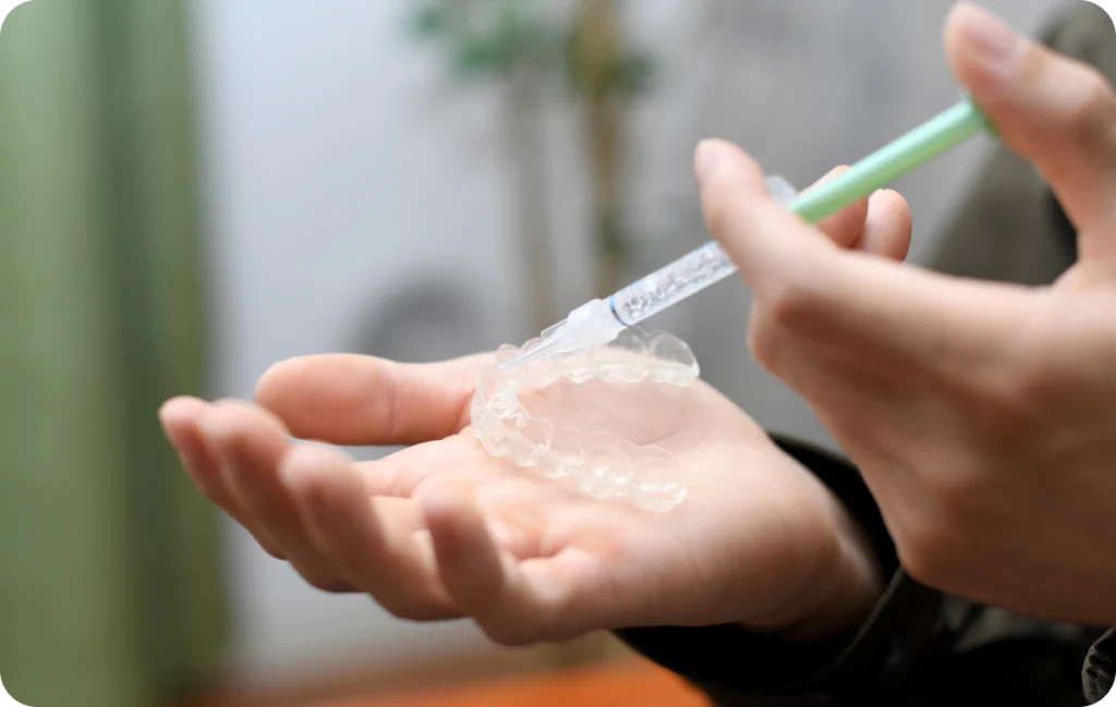 blanchiment dentaire dentisterie adhesive lagnieu Blanchiment dentaire Dr Benjamin Girod