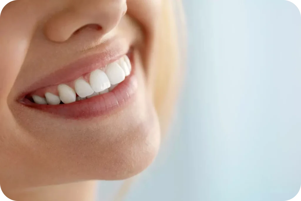 Dentisterie esthétique