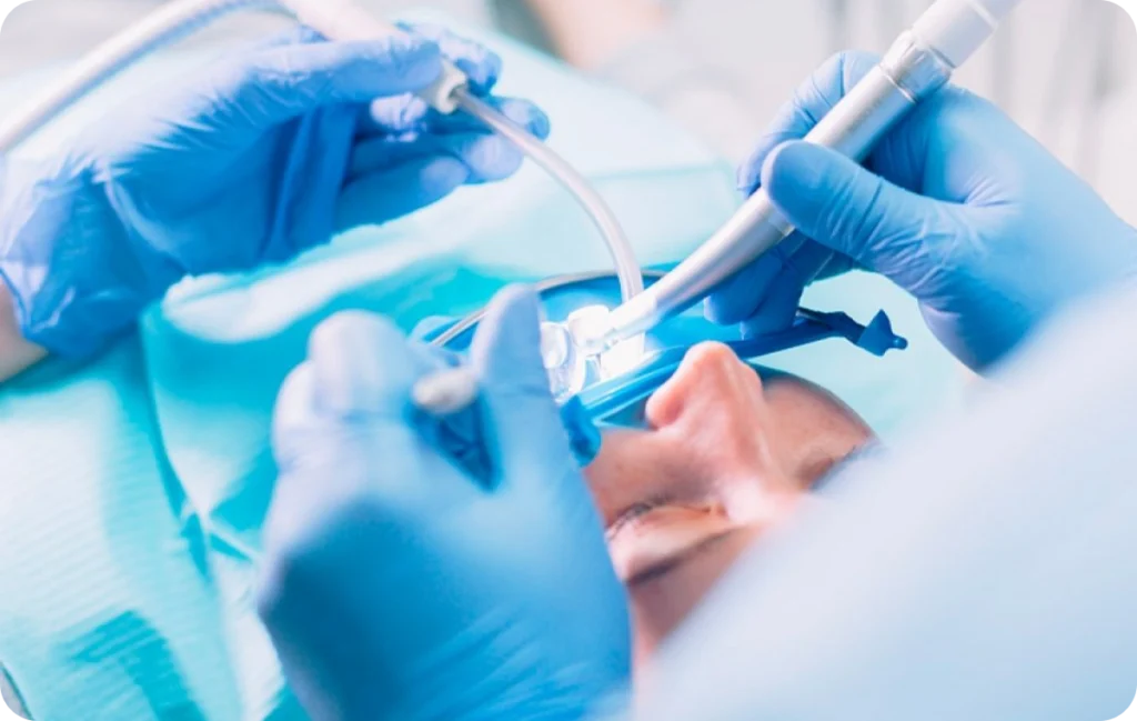 chirurgie dentaire lagnieu Chirurgie pré-implantaire Dr Benjamin Girod