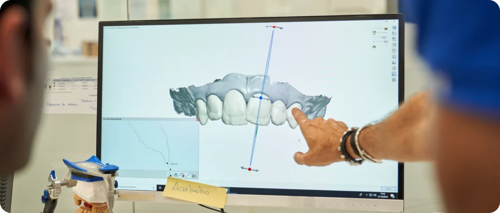 dentisterie adhesive implant rehabilitation lagnieu Réhabilitation dentaire Dr Benjamin Girod