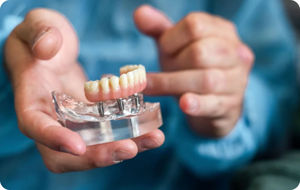 implant dentaire chirurgie preimplant lagnieu Dent manquante Dr Benjamin Girod