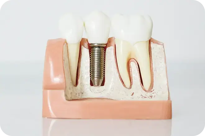 implantologie lagnieu Accueil Dr Benjamin Girod