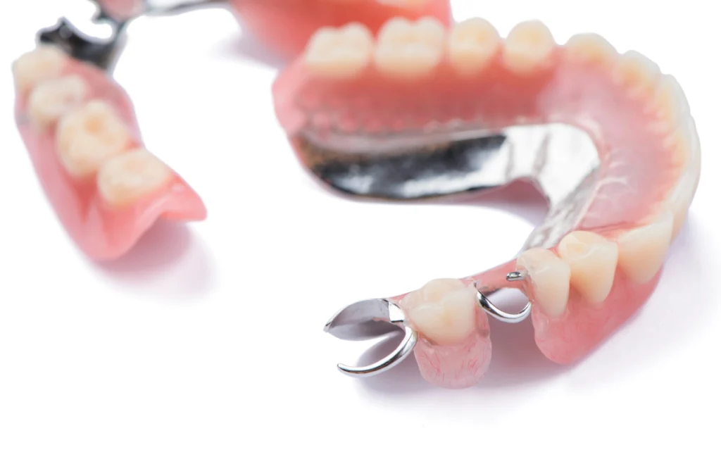 protheses amovibles protheses fixes lagnieu Prothèses amovibles Dr Benjamin Girod