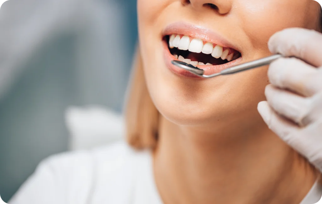 rehabilitation dentaire facettes dentaires Réhabilitation dentaire Dr Benjamin Girod